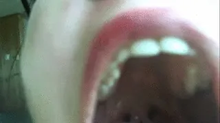 Divided Uvula Play 2