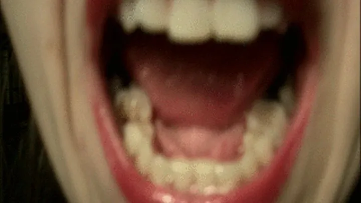 Teeth Examine