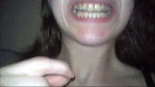 After Potato Chips - Teeth Picking & Sucking