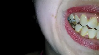 Teeth Picking & Sucking