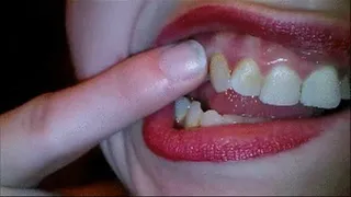 Gum Rubbing & Teeth Picking With Fingernail