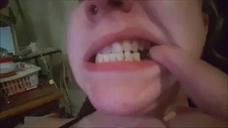 Mouth Tour: All Healed