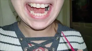 Pressure Sore Inside Gum Line