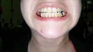 Teeth Picking (Floss)