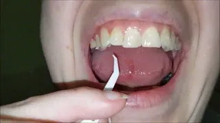 Chicken & Candy Lead To Teeth Picking