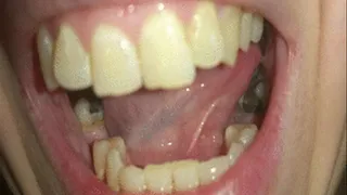 Teeth Sucking & Picking