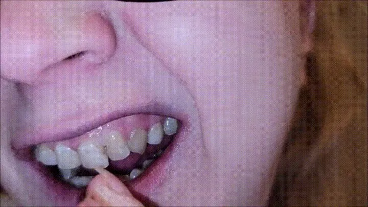 Tooth Picking After Dentist