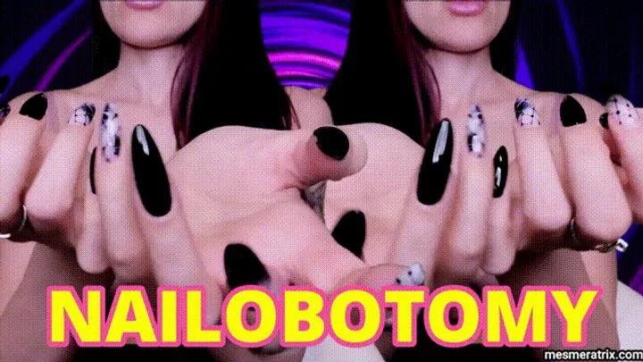 NAILOBOTOMY