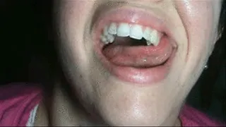 Mouth Exam: Teeth and Tongue!