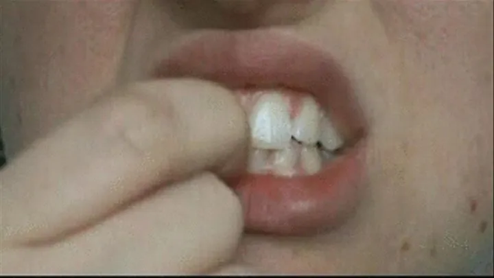 Picking at My Teeth with my nail!