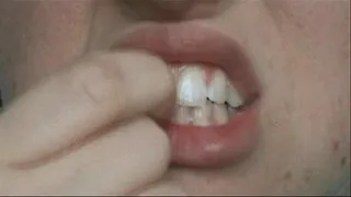 Something stuck in my teeth!
