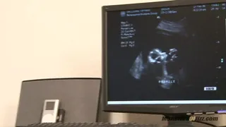 Pregnant Freak Sucks Off Male Nurse And Gets Tit Cumshot
