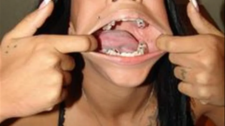 Inside Hollywoods Mouth