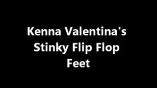 Kenna's Stinky Flip Flop Feet