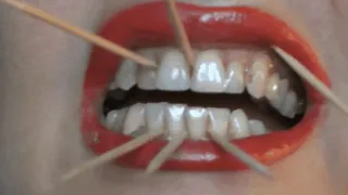 Gio' plays with my teeth ( LIP FETISH )