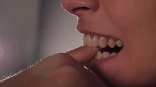 I denti di Stella, una morsa infallibile - Stella's teeth, an infallible grip
