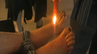 Foot with fire