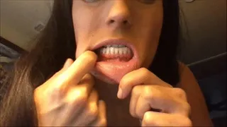 Veiny Gums and Teeth