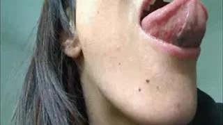 White Coated Tongue
