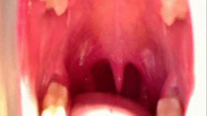 Swollen Red Throat