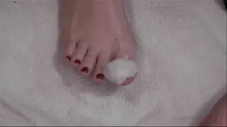 Toenail Polish Removal (Portable Version)