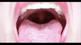 Perfect Mouth