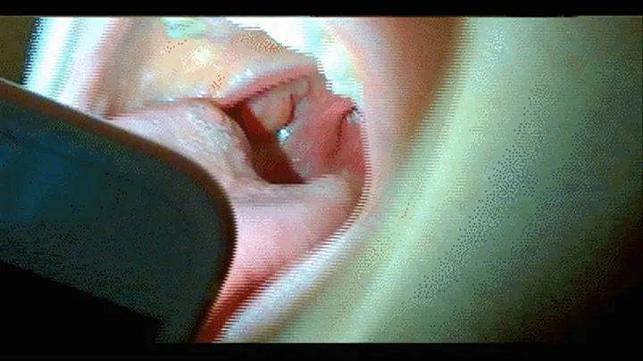 Red throat, swallen tonsils