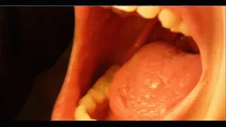 Teeth, mouth, tonsils and more...