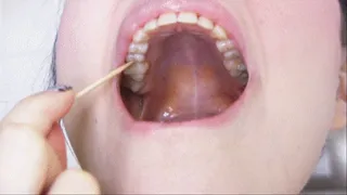 SEXY TEETH FOR A SEXY MOUTH