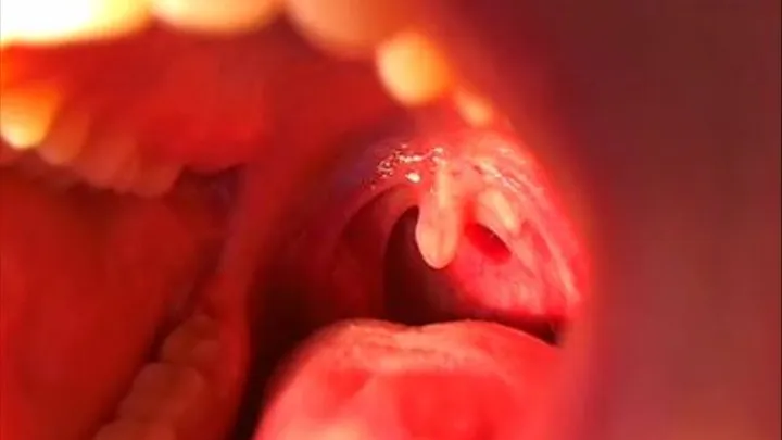 Tongue, Throat & Uvula- request
