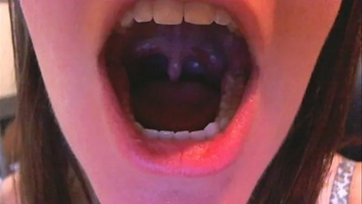 Look inside Sirens mouth! Uvula, tongue, and gums