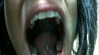 Inside my mouth 3