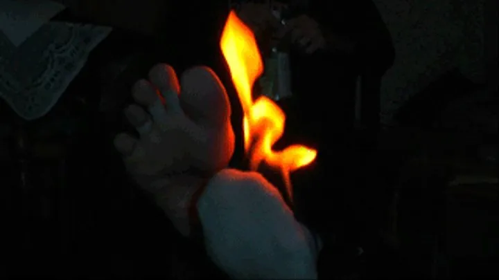 Socks and Foot BURNING