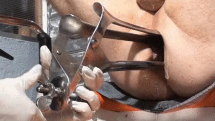 Speculum Anal Stretching