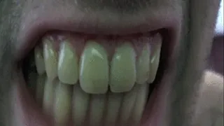 Up Close View of Giant Teeth Eating Banana