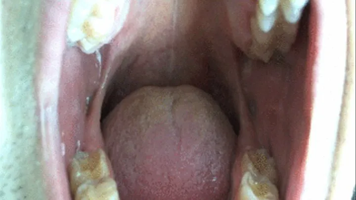 Explore Inside My Mouth