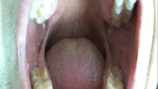 Explore Inside My Mouth