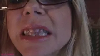 Alexa Has Lipstick On Teeth