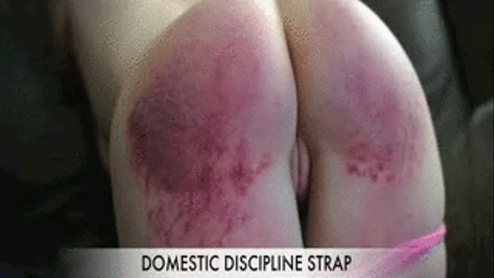 Purple Welts & Tears -Domestic Discipline Strapping