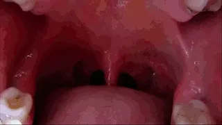 wild trip inside my throat