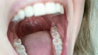 Another custon I chose - tongue and tonsil