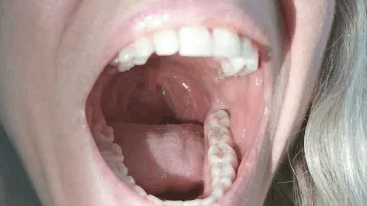 Super trip inside my mouth