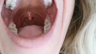 Sore throat
