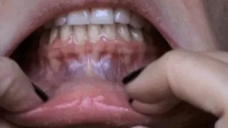 wild trip inside my mouth