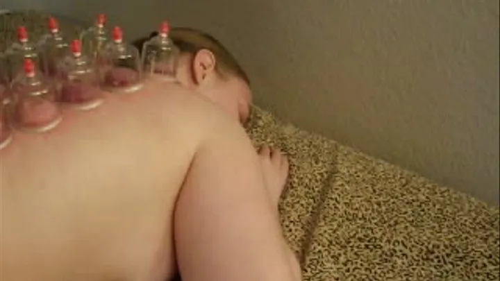Cupping with Ballgag, PART 2