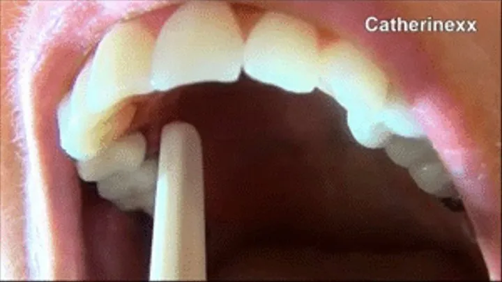 Dental Emergency/Tooth Extraction