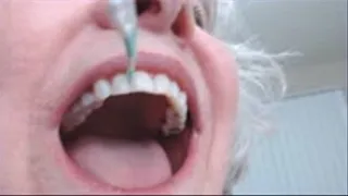 My Mouth Is A Goldmine Of Dental Work