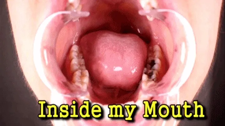 Inside my Mouth