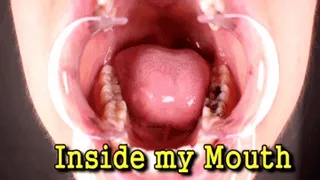 Inside my Mouth