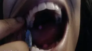Mouth, teeth, gum